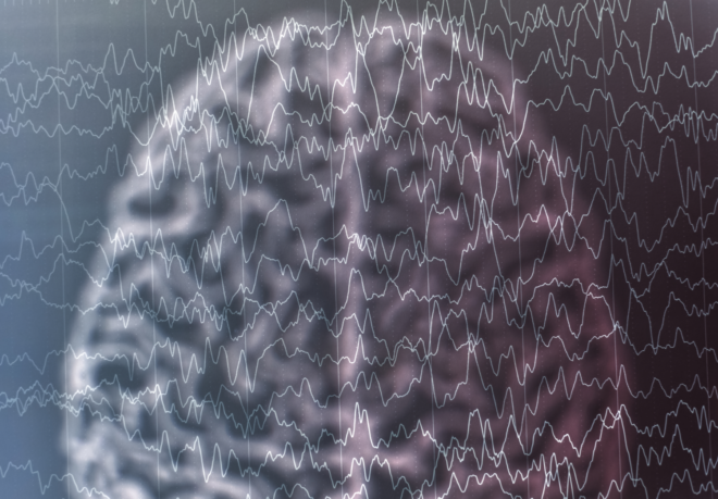 Epilepsy and EEG