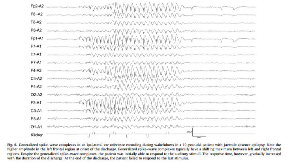 The Search for Seizures in EEG Sapien Labs Neuroscience Human