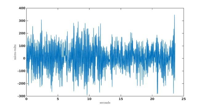 Factors that Impact Power Spectral Density Estimation - Sapien Labs ...