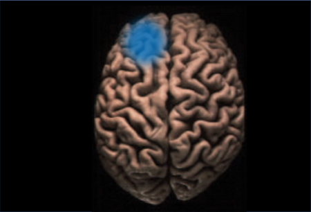 frontal asymmetry