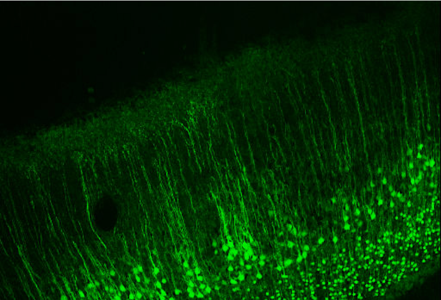 The Inverse Problem in EEG - Assumptions and Pitfalls - Sapien Labs ...