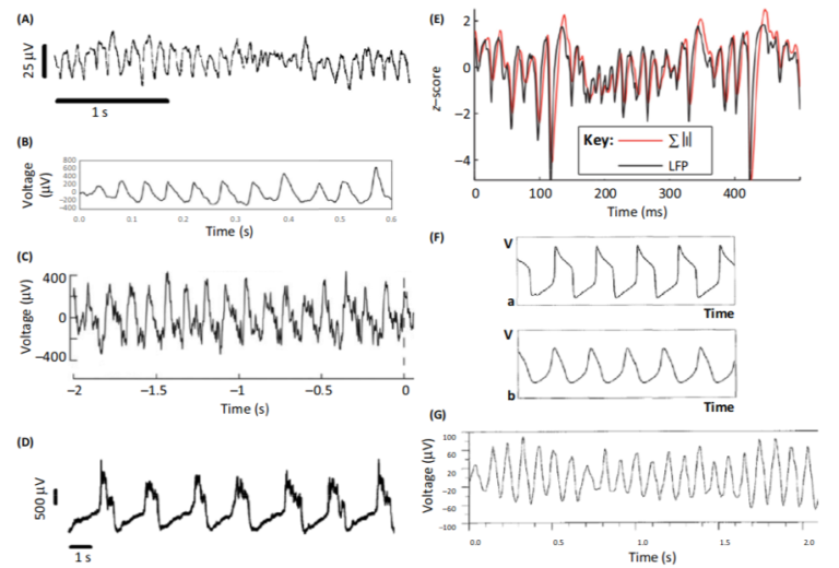 Brain Waves, Sine Waves And The Fourier Transform | Sapien Labs ...