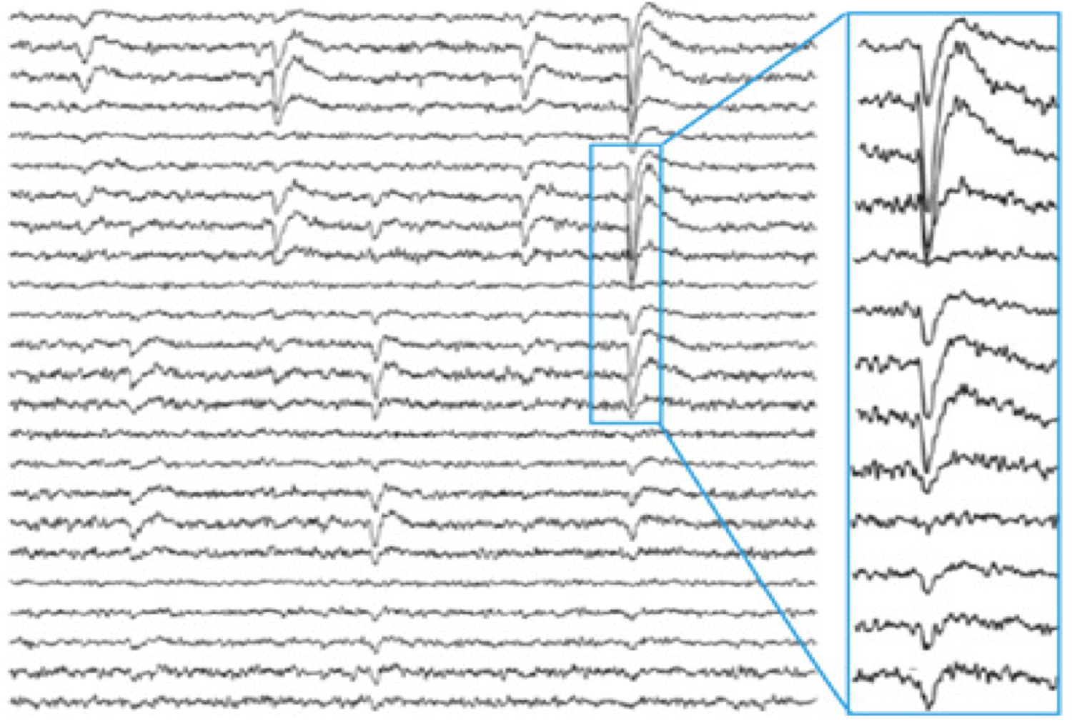 Neuronal Avalanches: What are They and What do They Mean?