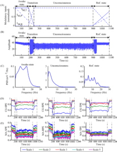 EEG Entropy and Anesthesia