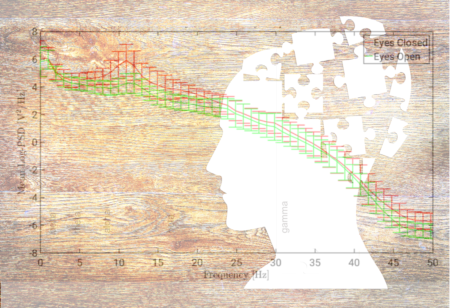 EEG Frequency Bands Mental Health