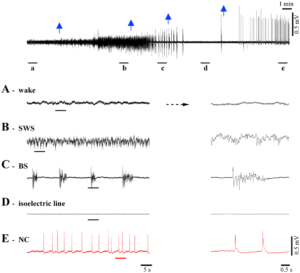 Nu complex isoelectric EEG