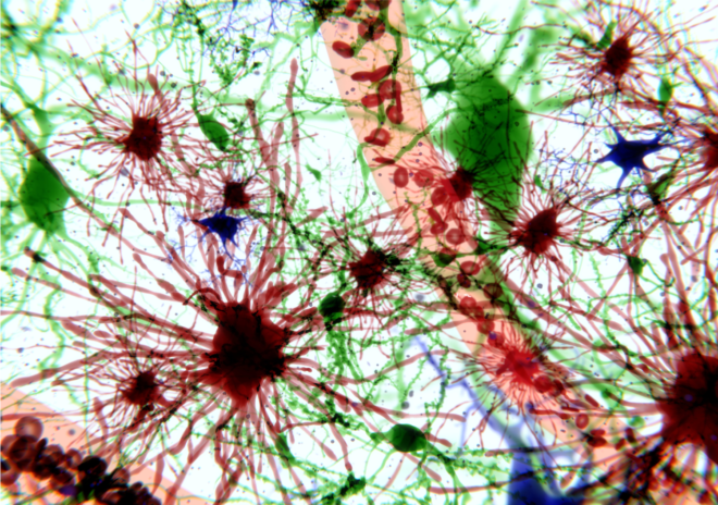 astrocytes in charge