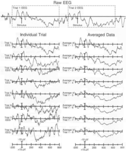 ERP Intelligent Neurons