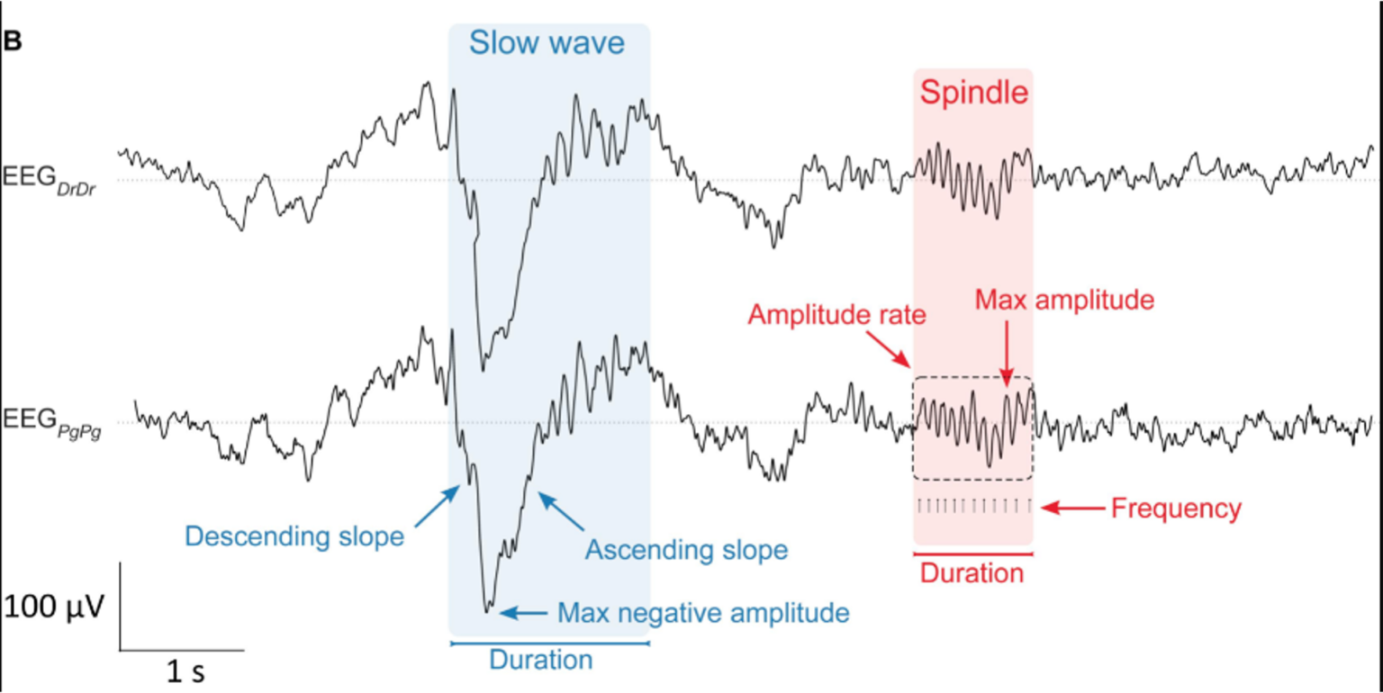 EEG Signal Quality in Wet Versus Dry Electrodes Sapien Labs