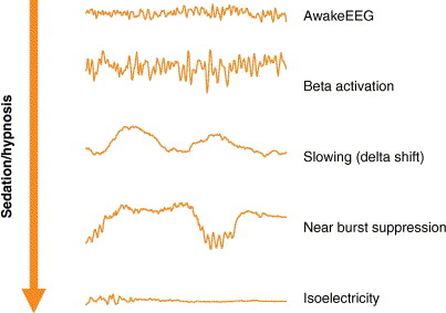 EEG Approaches To Measuring Depth Of Anesthesia - Sapien Labs ...